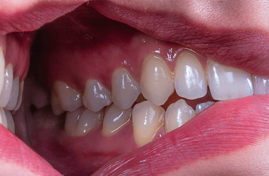 Periodontia